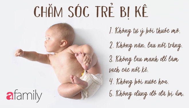 Những tưởng con mắc 4 chứng bệnh về da nhưng sau cùng mẹ thở phào vì bé chỉ bị loại mụn nhẹ này thôi