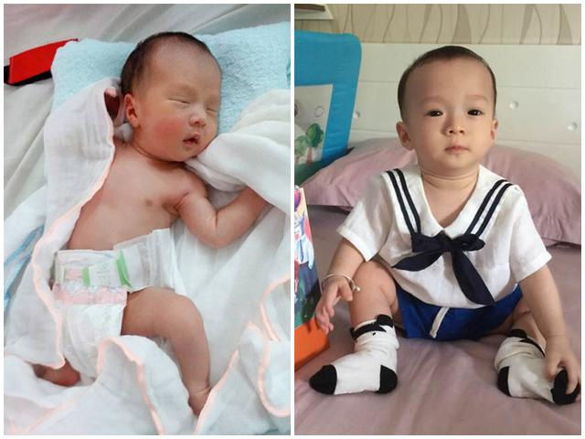Ụt sinh non (ảnh trái) và thời điểm hiện tại (ảnh phải) tròn 8 tháng tuổi.