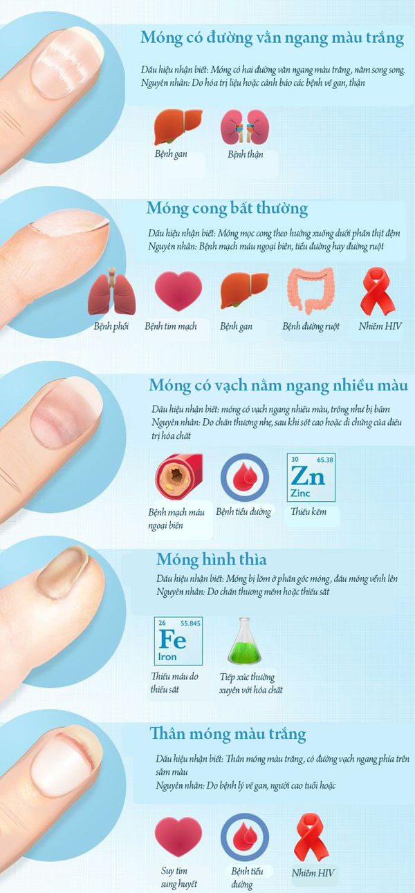 5 dấu hiệu khác thường trên móng tay cảnh báo vấn đề sức khỏe