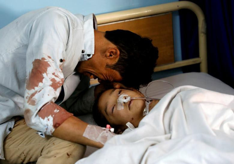   Người đàn ông gục khóc bên cạnh bé gái bị thương trong bệnh viện, sau cuộc đánh bom liều chết ở thủ đô Kabul, Afghanistan.  