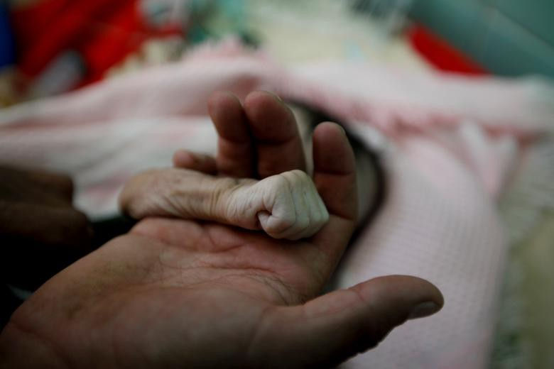 Nạn đói ở Yemen: Ông Saleh Hassan al-Faqeh cầm lấy cánh tay nhỏ bé của con gái 4 tháng tuổi, đã chết vì suy dinh dưỡng ở bệnh viện Sanaa. Y tá nói rằng em vẫn còn ý thức khi nhập viện nhưng sau đó hạ oxy máu nhanh chóng: 