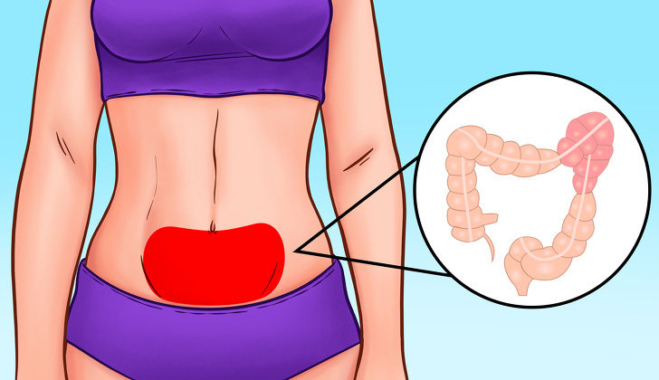 Vị trí đau bụng tiết lộ gì về sức khỏe của bạn?
