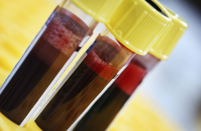 Xét nghiệm máu các nhà khoa học có thể dự đoán được thời gian chết của bạn