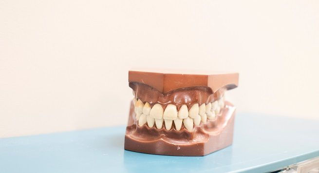 5 lầm tưởng tai hại về quy trình làm trắng răng hiện nay  