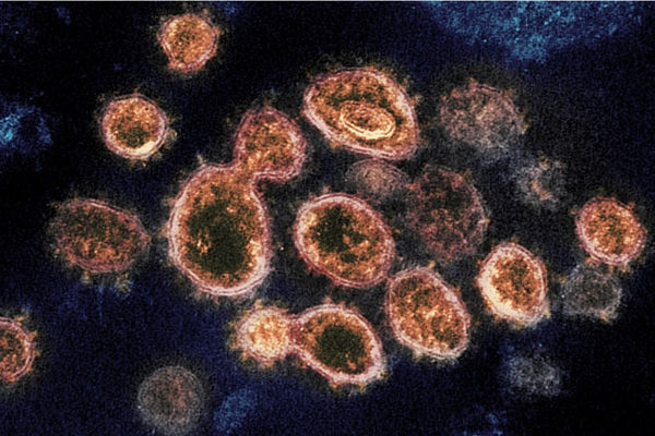 Hình ảnh virus SARS-CoV-2 dưới kính hiển vi điện tử.