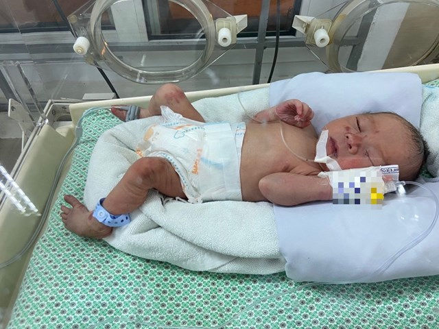 Bé sơ sinh bị bỏ rơi đang được điều trị tại Bệnh viện đa khoa Xanh Pôn. Ảnh: Đại Đoàn Kết.