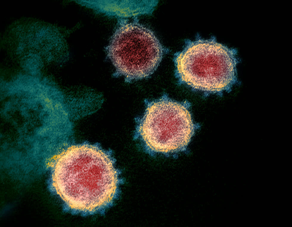   Một bức ảnh hiển vi điện tử truyền qua của những phần tử virus SARS-CoV-2. Ảnh: Wikipedia  