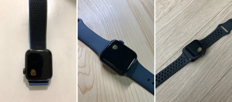 Apple Watch SE gặp lỗi quá nhiệt, khiến người dùng bị bỏng