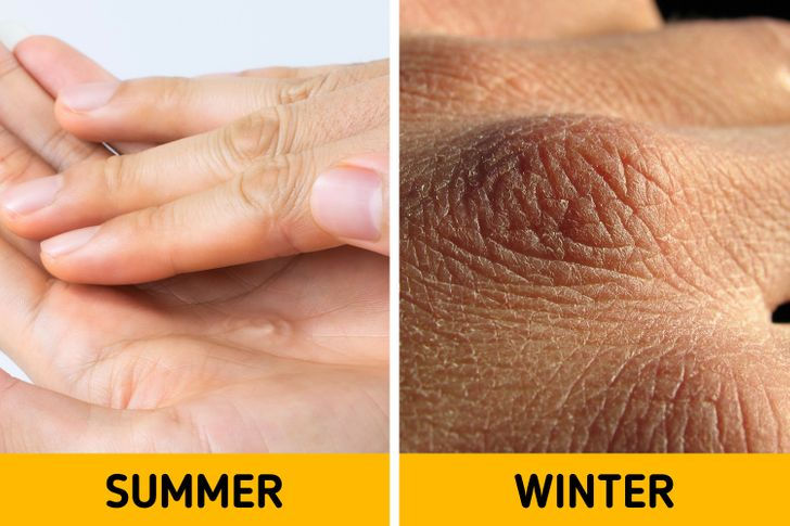 7 điều có thể xảy ra với cơ thể bạn vào mùa đông