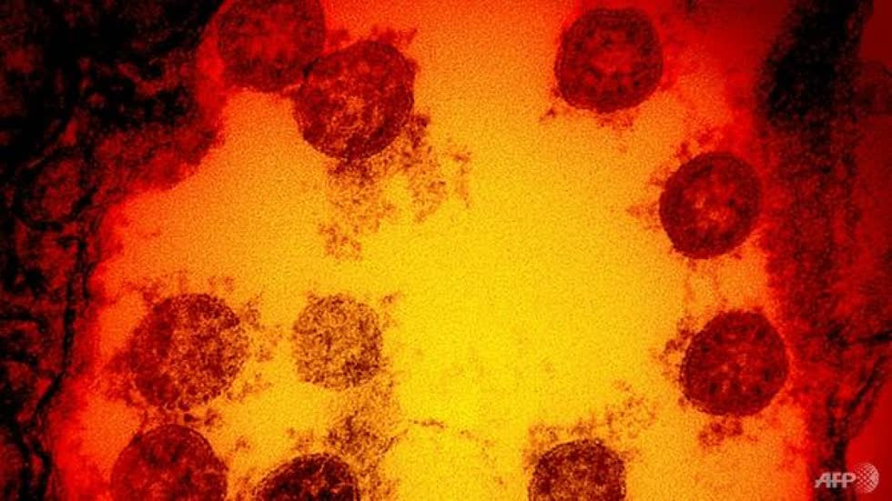 Biến chủng mới của virus SARS-CoV-2 tại Anh có khả năng lây nhiễm cao hơn 70%. Ảnh: AFP.