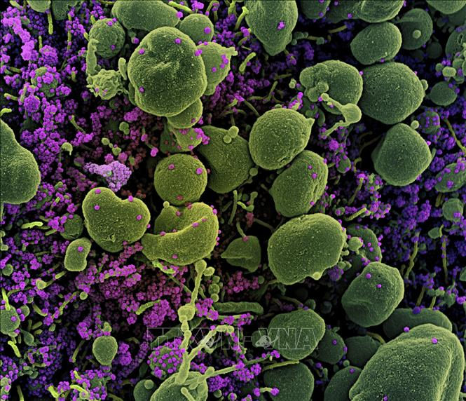 Hình ảnh quét qua kính hiển vi điện tử cho thấy tế bào (màu xanh) bị virus SARS-COV-2 (màu tím) xâm nhập, lấy từ mẫu bệnh phẩm của bệnh nhân COVID-19 tại Viện Nghiên cứu Dị ứng và Bệnh Truyền nhiễm Quốc gia Mỹ. Ảnh minh họa: AFP