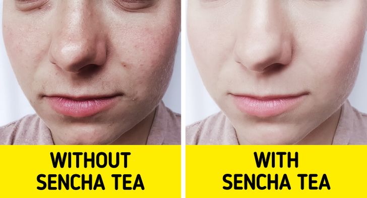 Cách uống trà Sencha giúp phụ nữ Nhật có làn da trắng sáng - Ảnh 4.