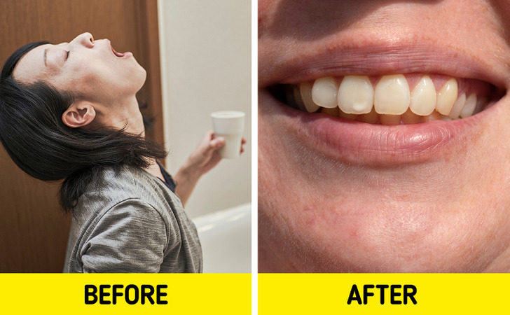 6 điều bạn đang làm mỗi ngày có thể khiến răng bị ố vàng - Ảnh 4.