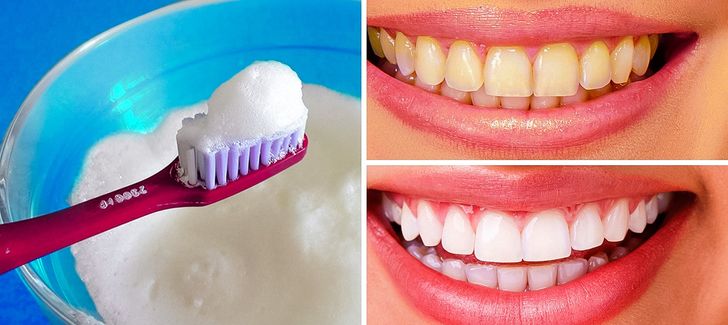 10 cách tốt nhất để làm trắng răng bị ố vàng tại nhà - Ảnh 10.