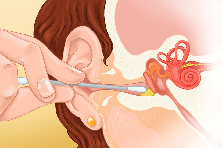 Tại sao bạn nên ngừng vệ sinh tai bằng tăm bông và cách để thay thế - Ảnh 1.