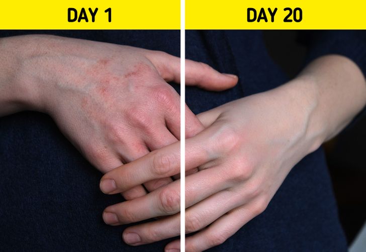 8 cách để phục hồi bàn tay khô của bạn tại nhà - Ảnh 8.