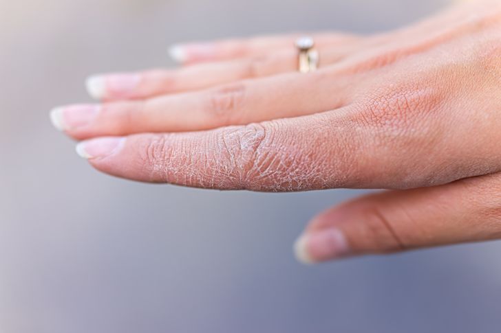 8 cách để phục hồi bàn tay khô của bạn tại nhà - Ảnh 9.