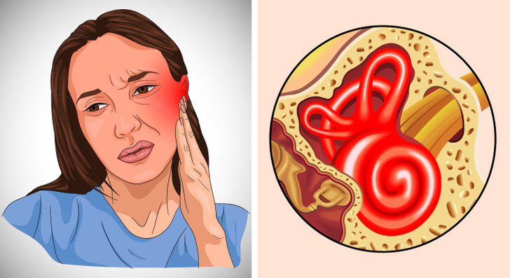 6 dấu hiệu cho thấy bạn bị nhiễm trùng tai và cách phòng ngừa chúng - Ảnh 2.