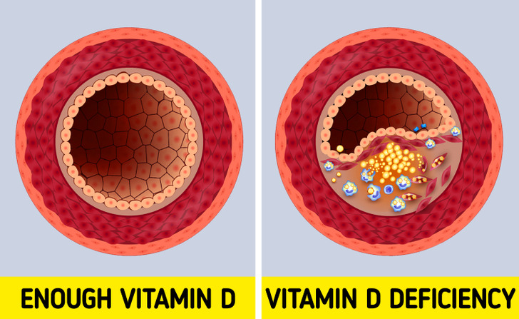 6 dấu hiệu cảnh báo bạn đang thiếu vitamin D - Ảnh 3.