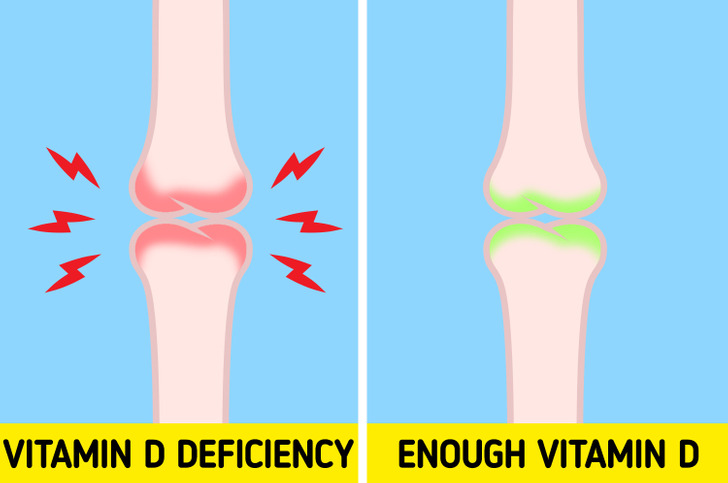 6 dấu hiệu cảnh báo bạn đang thiếu vitamin D - Ảnh 4.
