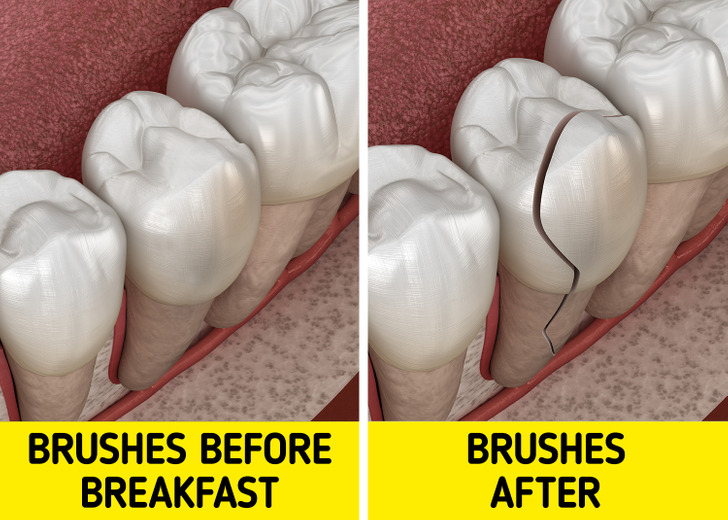 Tại sao không nên đánh răng sau khi ăn sáng? - Ảnh 1.