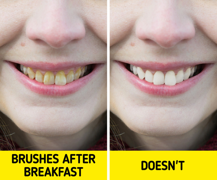 Tại sao không nên đánh răng sau khi ăn sáng? - Ảnh 2.