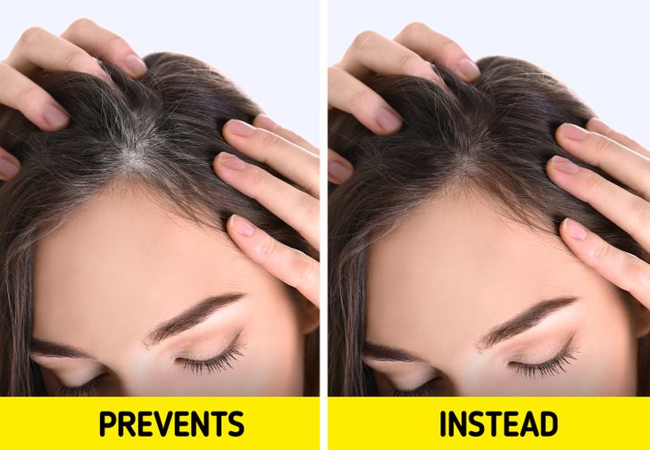 10 biện pháp hỗ trợ điều trị và ngăn ngừa tóc bạc - Ảnh 2.