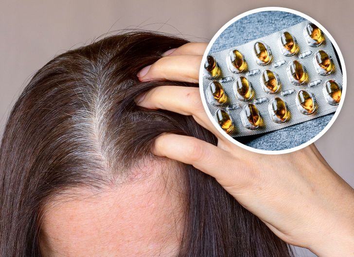 10 biện pháp hỗ trợ điều trị và ngăn ngừa tóc bạc - Ảnh 3.