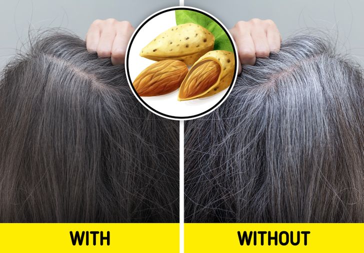 10 biện pháp hỗ trợ điều trị và ngăn ngừa tóc bạc - Ảnh 7.