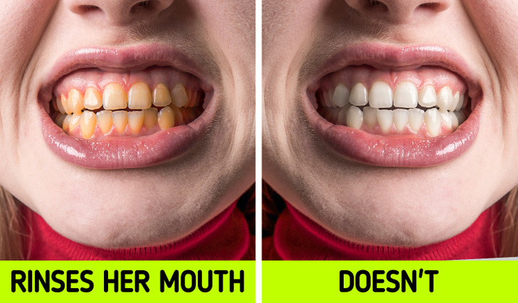 6 sai lầm khi đánh răng khiến răng yếu đi từng ngày - Ảnh 1.
