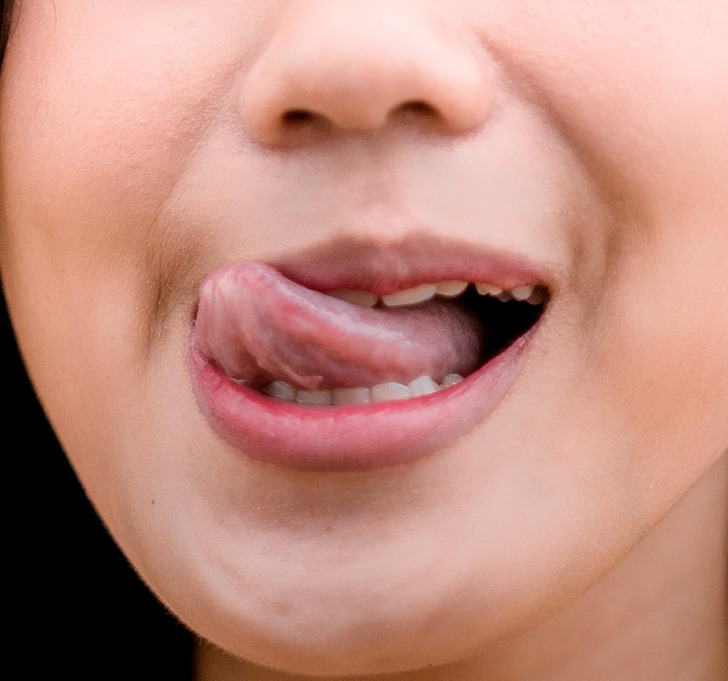 8 biện pháp khắc phục đôi môi khô nứt nẻ của bạn - Ảnh 9.