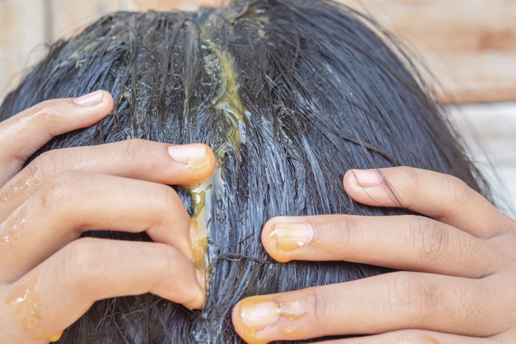 8 biện pháp khắc phục tình trạng rụng tóc một cách tự nhiên - Ảnh 3.