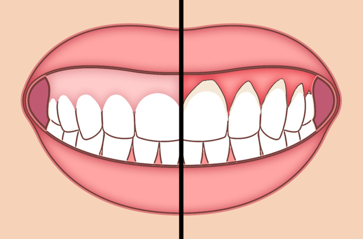 Áp dụng 6 thói quen này để bảo vệ sức khỏe răng miệng - Ảnh 1.