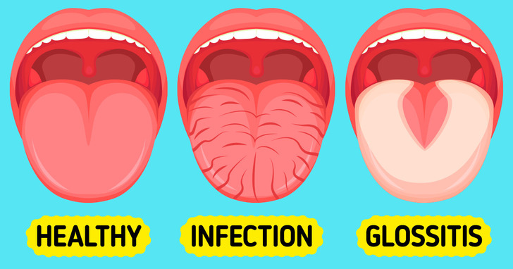 Áp dụng 6 thói quen này để bảo vệ sức khỏe răng miệng - Ảnh 2.