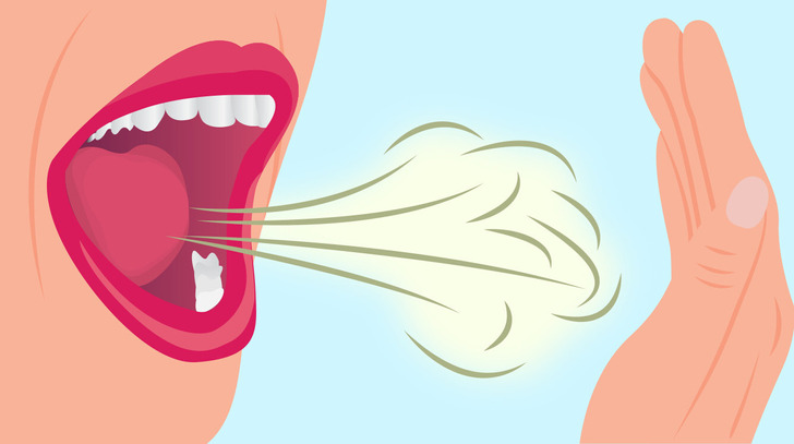 Áp dụng 6 thói quen này để bảo vệ sức khỏe răng miệng - Ảnh 3.