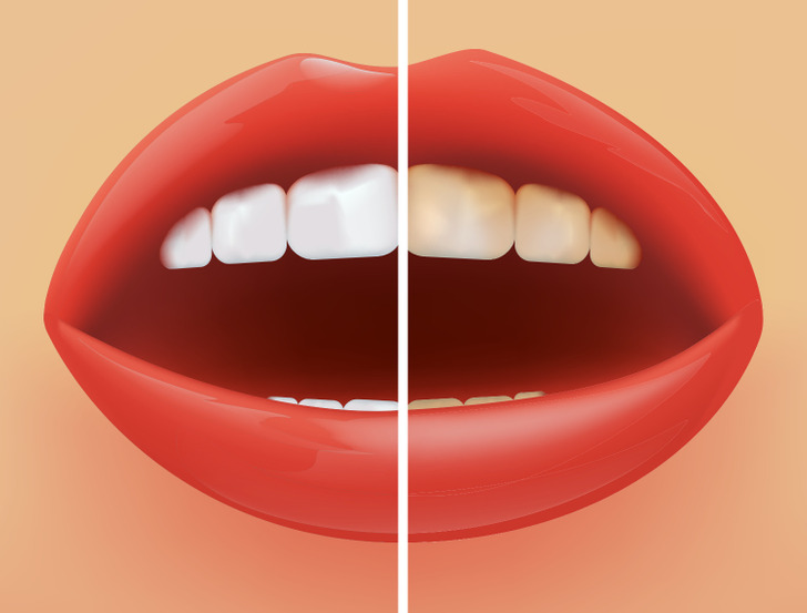 Áp dụng 6 thói quen này để bảo vệ sức khỏe răng miệng - Ảnh 5.