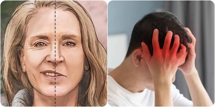 7 triệu chứng sắp bị đột quỵ cần lưu ý và xử lý ngay- Ảnh 1.