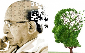 Mỹ yêu cầu dữ liệu bệnh nhân để thanh toán chi phí cho loại thuốc mới điều trị Alzheimer