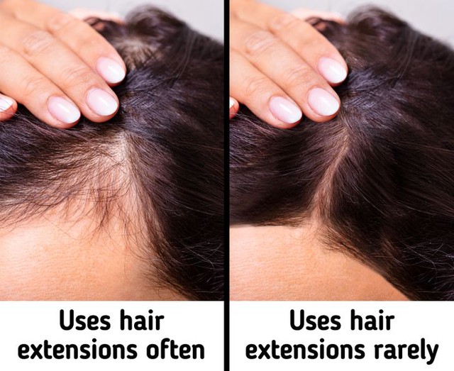 10 sai lầm cần tránh để có mái tóc khỏe mạnh - Ảnh 6.