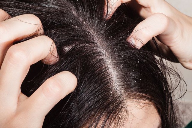 10 sai lầm cần tránh để có mái tóc khỏe mạnh - Ảnh 8.