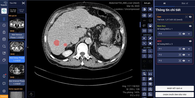 Vinbrain bắt tay BV ĐHYD TP.HCM phát triển ứng dụng AI, chuẩn đoán ung thư gan - Ảnh 1.