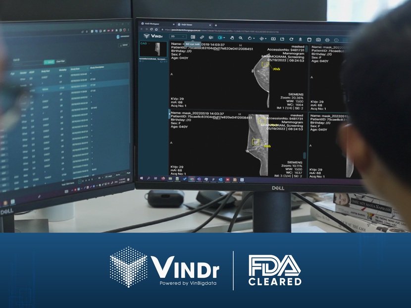 Đạt chuẩn FDA khắt khe, sản phẩm AI của VinBigdata rộng cửa kinh doanh trên toàn cầu- Ảnh 1.