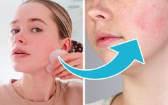 7 sản phẩm chăm sóc có thể gây hại cho da, rất nhiều người không biết