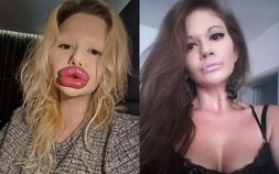 Nhan sắc mê hồn của cô gái có cặp môi lớn nhất thế giới trước khi 'dao kéo'
