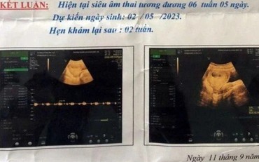 Nghi phạm 70 tuổi trong vụ xâm hại bé 6 tuổi đến mang thai đã tử vong