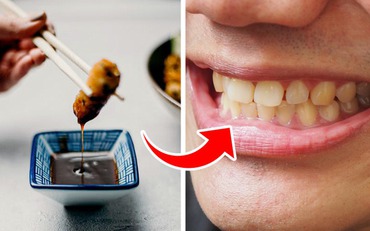 6 điều bạn đang làm mỗi ngày có thể khiến răng bị ố vàng