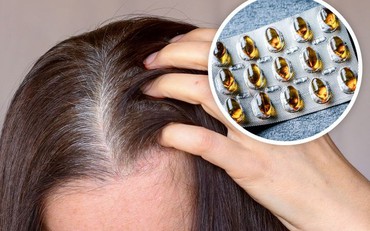 10 biện pháp hỗ trợ điều trị và ngăn ngừa tóc bạc