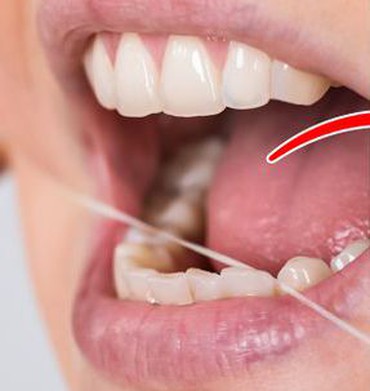 7 lời khuyên bổ ích giúp răng trắng sáng khỏe mạnh