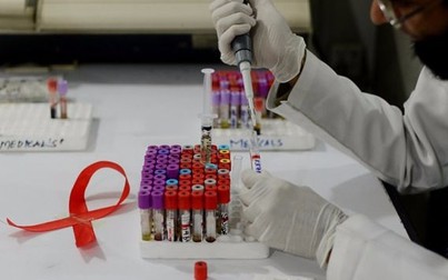 Các nhà nghiên cứu Cuba thử nghiệm vắcxin điều trị HIV/AIDS