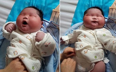Bé sơ sinh 6,7 kg chào đời ở Trung Quốc